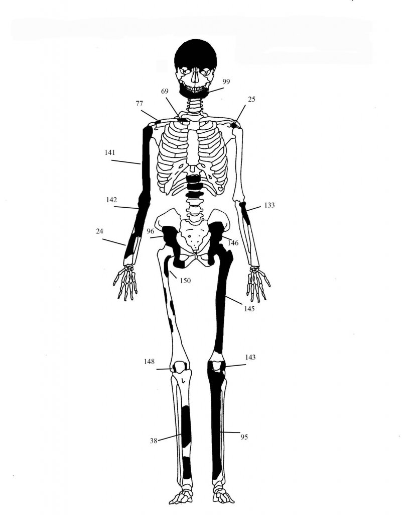 skeletos 1