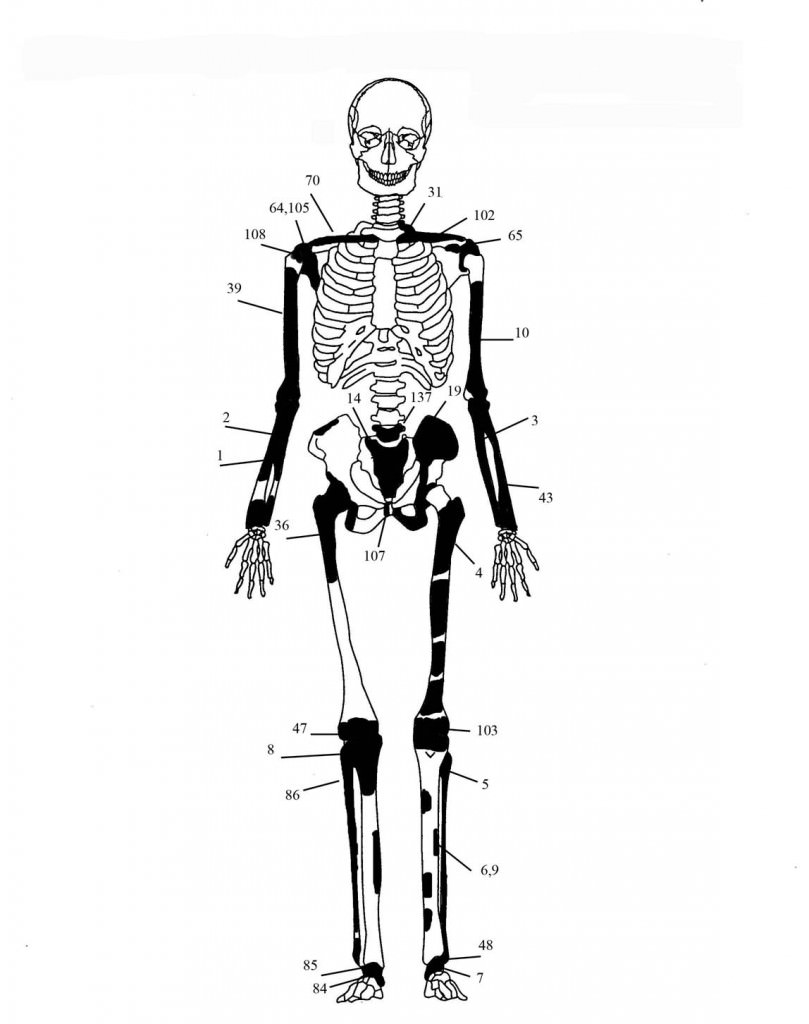 skeletos 3