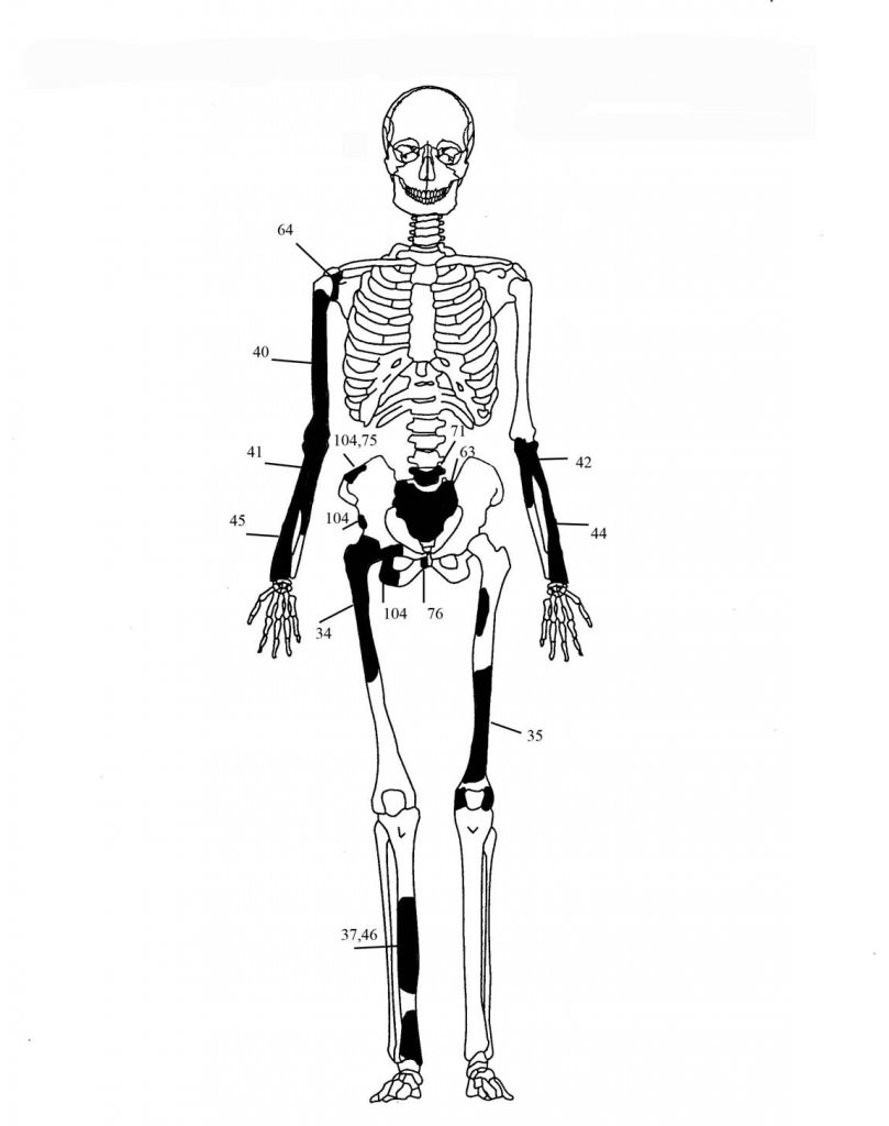 skeletos 5